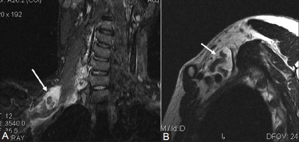 Figure 4(A, B)