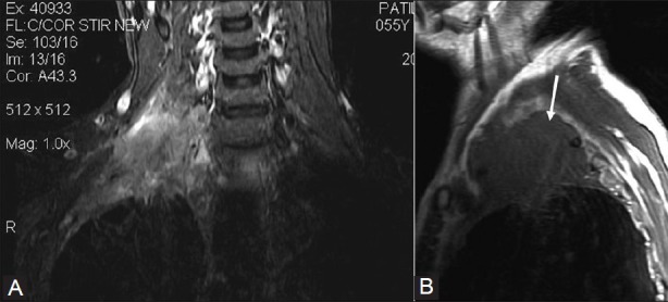 Figure 11(A, B)