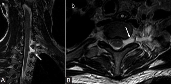 Figure 2(A, B)