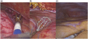Figure 3: