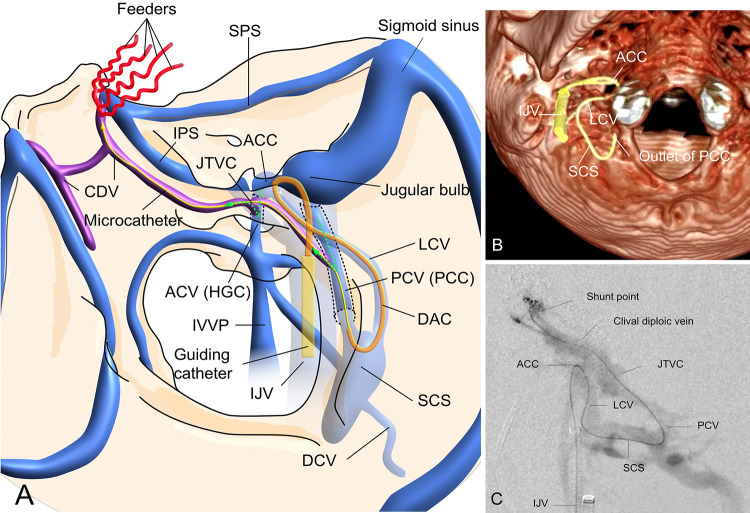 FIG. 3