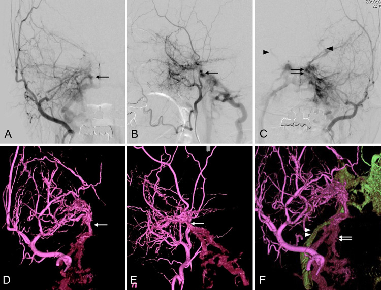 FIG. 1