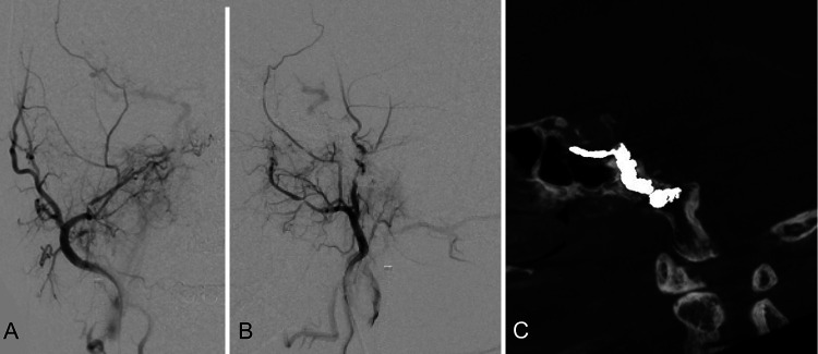 FIG. 4