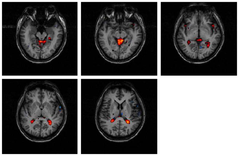 Fig. 14