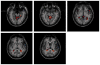 Fig. 14