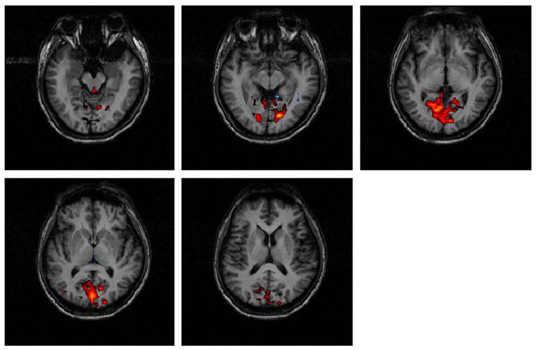 Fig. 13