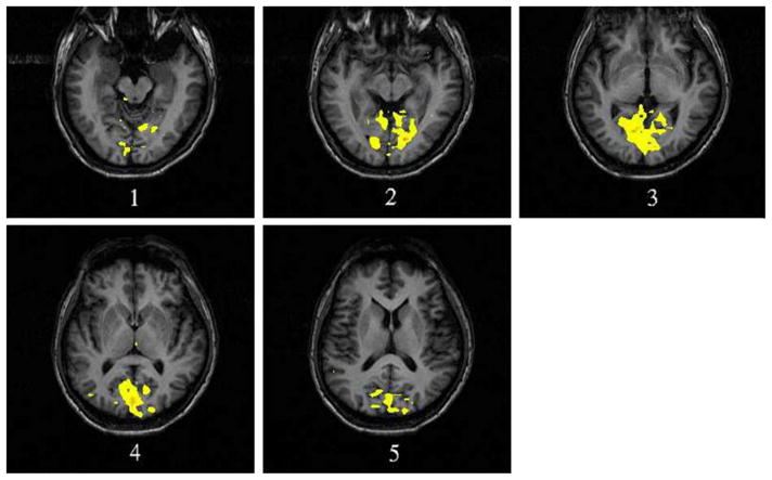 Fig. 3