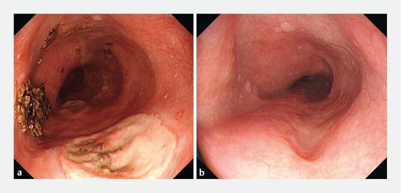 Fig. 3