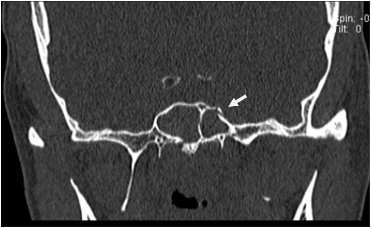 Fig. 3