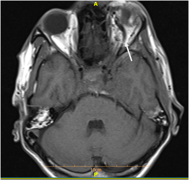 Fig. 5