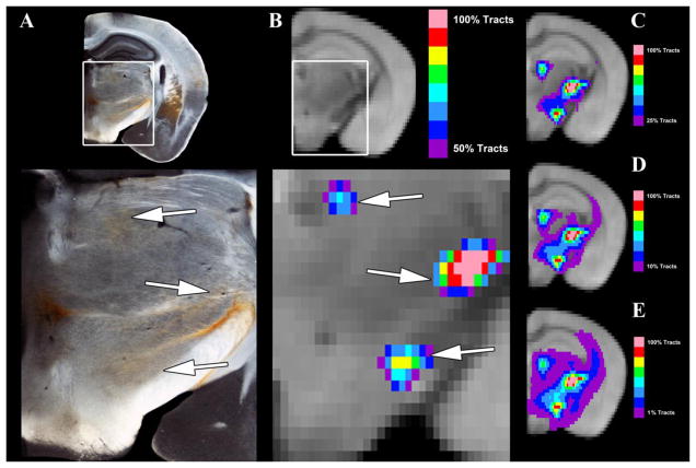 A Comparative Analysis of Mouse and Human Medial Geniculate Nucleus ...