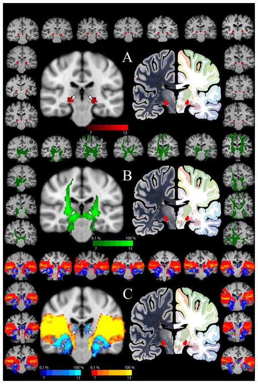 A Comparative Analysis of Mouse and Human Medial Geniculate Nucleus ...