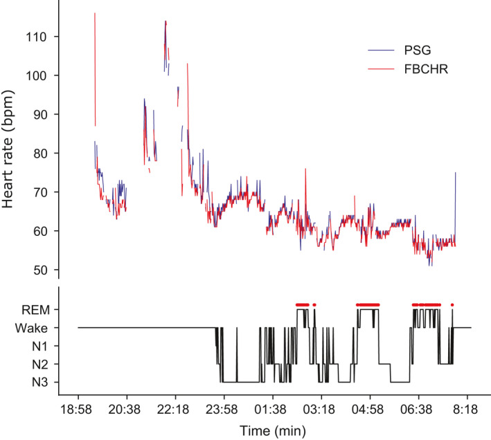 FIGURE 1