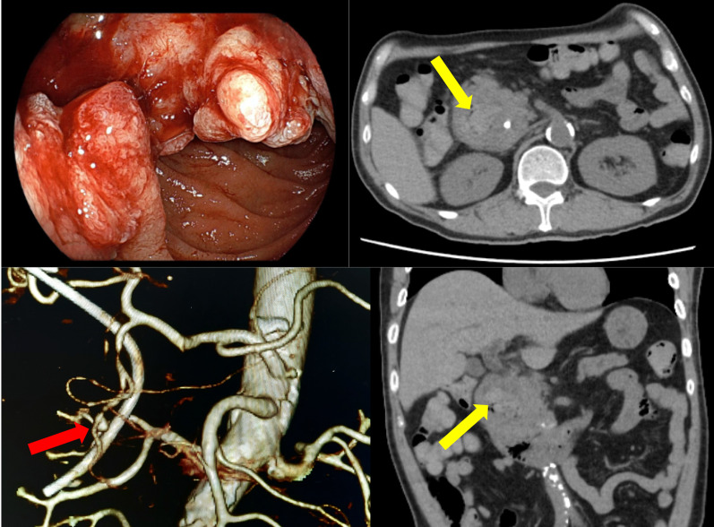 Fig. 3