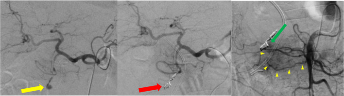 Fig. 4