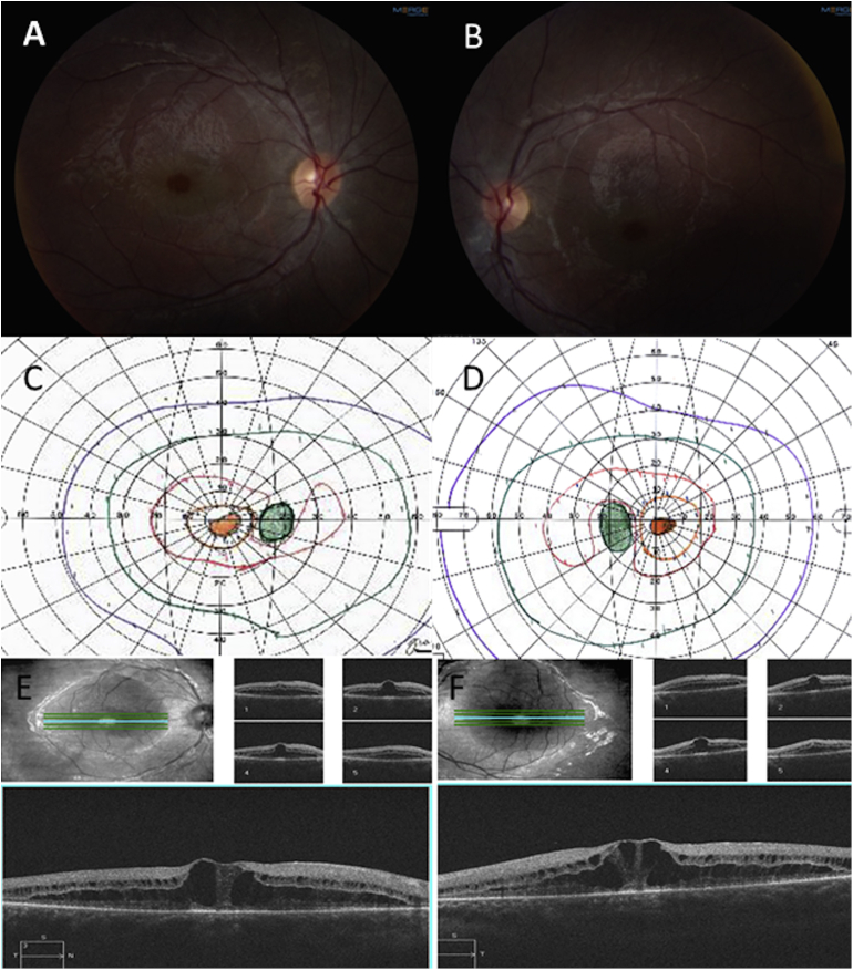 Fig. 1