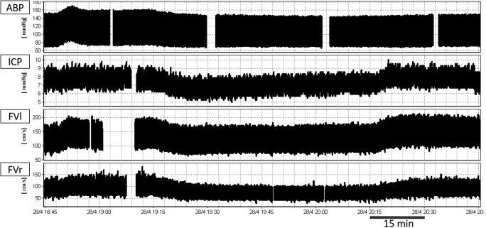 Fig. 2