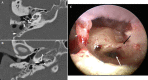 Figure 15.