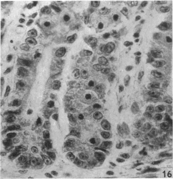 Fig. 16