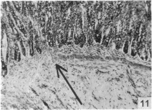 Fig. 11