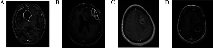 FIG 3