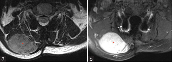 Figure 2: