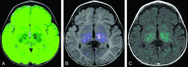 Fig 8.