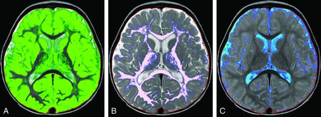 Fig 7.