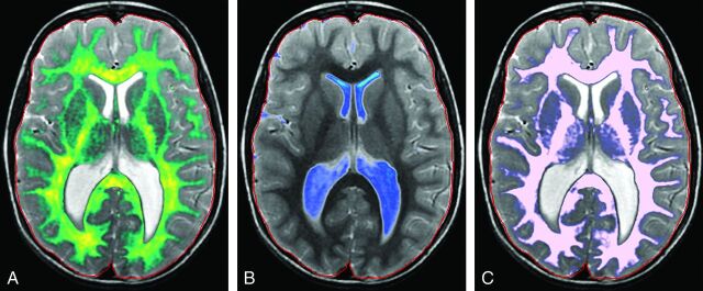 Fig 6.