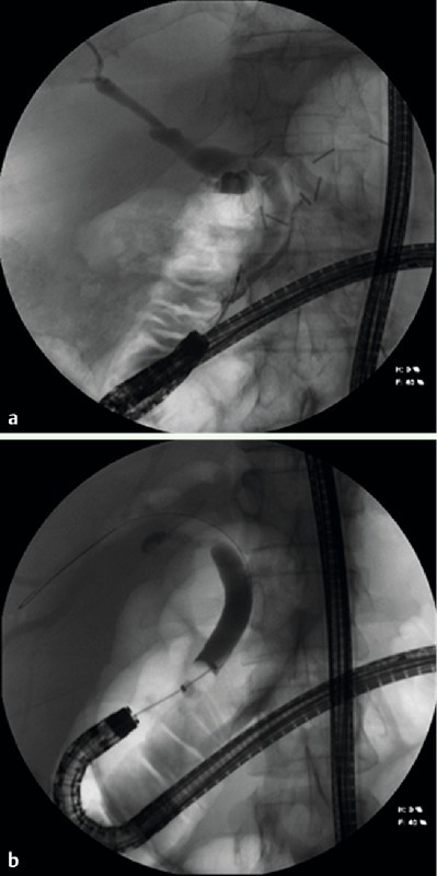 Fig. 2