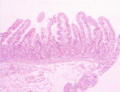 graphic file with name t03804-01-9780123864567.gif
