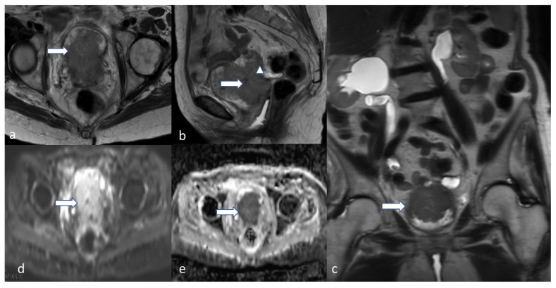 Figure 13