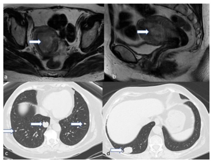 Figure 16