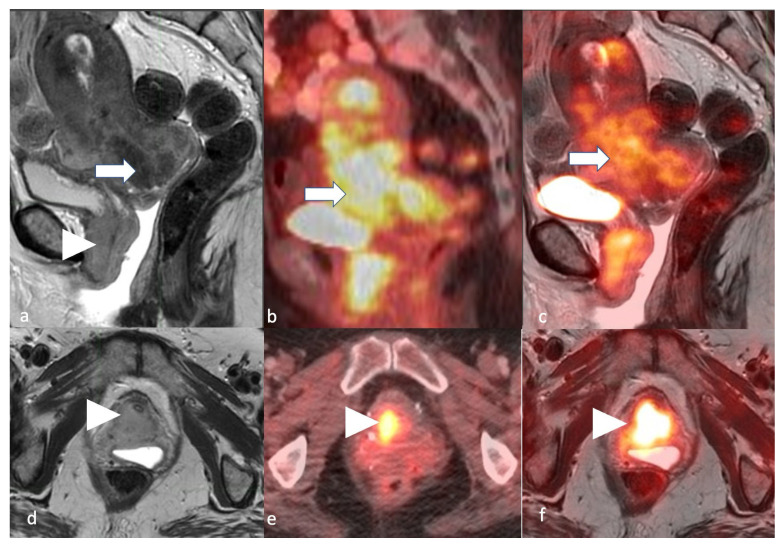 Figure 19