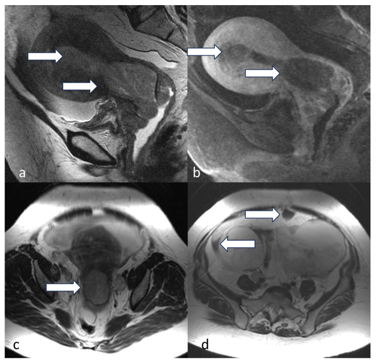 Figure 15