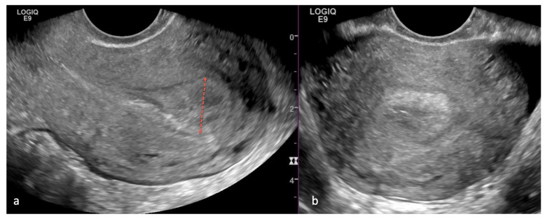 Figure 17