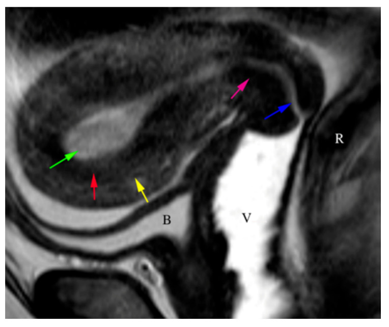 Figure 18