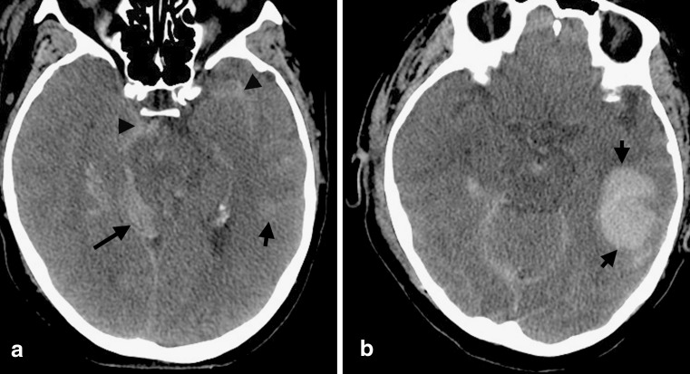 FIG. 7