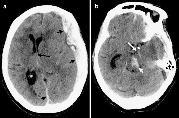 FIG. 11