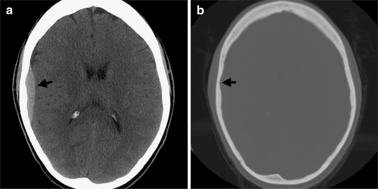 FIG. 1