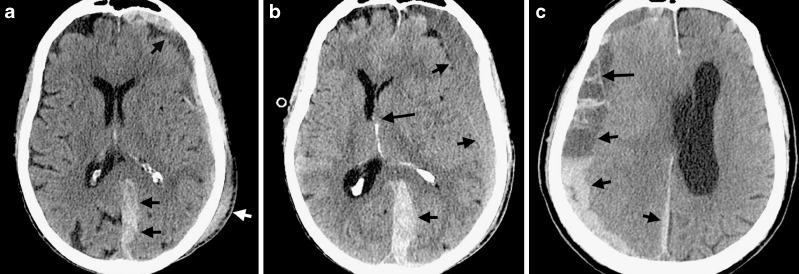 FIG. 5