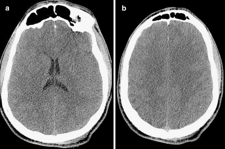 FIG. 10