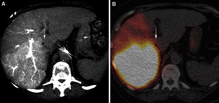 Fig. 6