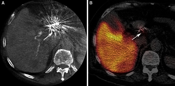 Fig. 3