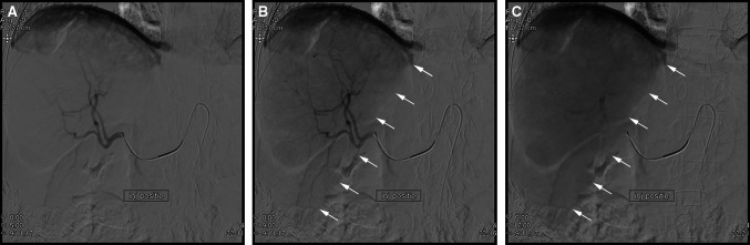 Fig. 2