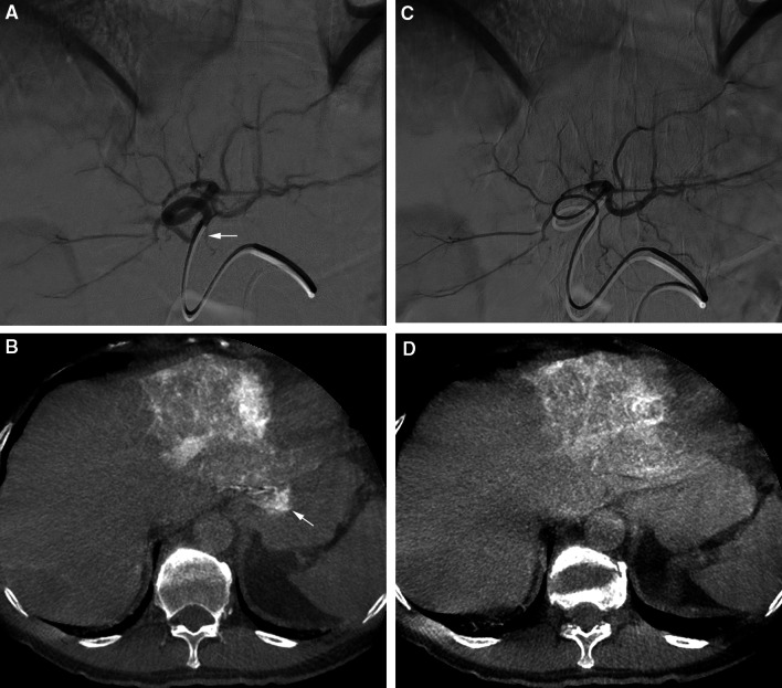 Fig. 4