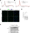 Figure 4—figure supplement 1.