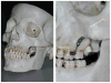 Fig 10