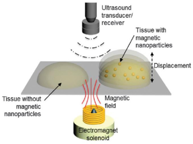 Figure 18