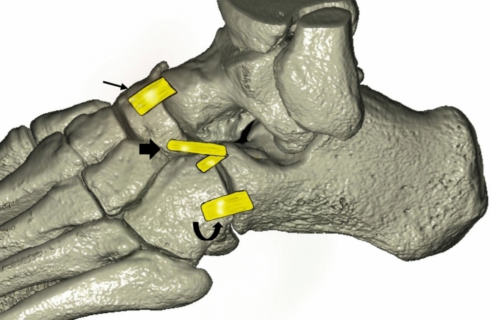 Fig. 1